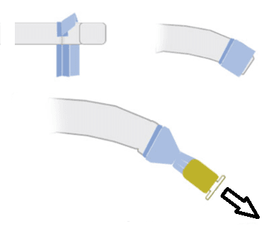 T-Tape method